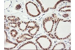 Image no. 2 for anti-Adipocyte Plasma Membrane Associated Protein (APMAP) antibody (ABIN1496662) (APMAP anticorps)