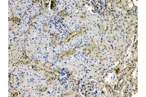 IHC testing of FFPE rat kidney tissue with Purine nucleoside phosphorylase antibody at 1ug/ml. (PNP anticorps  (AA 161-189))