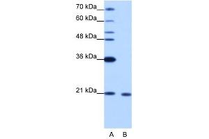 RBM8A antibody used at 1. (RBM8A anticorps  (N-Term))