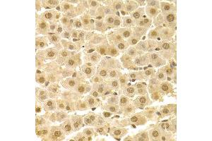Immunohistochemistry of paraffin-embedded rat liver using CDK4 Antibody.