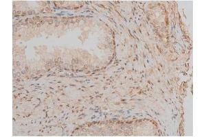 ABIN6267399 at 1/200 staining Human prostate tissue sections by IHC-P. (CREB1 anticorps  (pSer142))