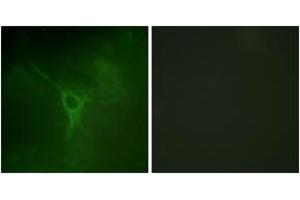 Immunofluorescence analysis of COS7 cells, using GFAP (Phospho-Ser38) Antibody. (GFAP anticorps  (pSer38))