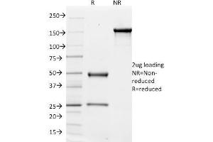 SDS-PAGE Analysis Purified CD51 / Integrin 'V Mouse Monoclonal Antibody (ITGAV/1610). (CD51 anticorps)