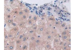 Detection of ETFb in Human Liver Tissue using Polyclonal Antibody to Electron Transfer Flavoprotein Beta Polypeptide (ETFb)