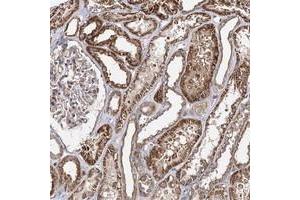 Immunohistochemical staining of human kidney with SEC24B polyclonal antibody  shows strong cytoplasmic positivity in cells in tubules at 1:200-1:500 dilution. (SEC24B anticorps)