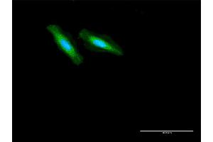 Immunofluorescence of purified MaxPab antibody to GCDH on HeLa cell.