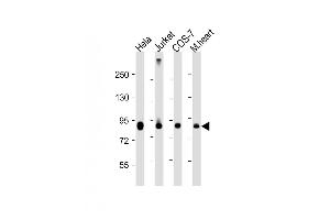 All lanes : Anti-PFKP Antibody (C-term) at 1:4000 dilution Lane 1: Hela whole cell lysate Lane 2: Jurkat whole cell lysate Lane 3: COS-7 whole cell lysate Lane 4: mouse heart lysate Lysates/proteins at 20 μg per lane. (PFKP anticorps  (C-Term))