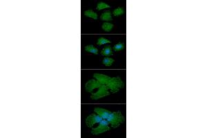 ICC/IF analysis of NQO2 in A549 cell line, stained with DAPI (Blue) for nucleus staining and monoclonal anti-human NQO2 antibody (1:100) with goat anti-mouse IgG-Alexa fluor 488 conjugate (Green).