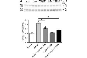 Ex vivo studies on isolated cortical tubules from mouse kidney highlight a role for CAMKK and PI3K in VP signaling in mpkDCT cells. (SLC12A3 anticorps  (AA 74-95))