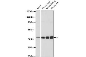 Western blot analysis of extracts of various cell lines, using IVD antibody (ABIN7268031) at 1:1000 dilution. (IVD anticorps  (AA 33-200))