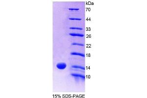 SDS-PAGE analysis of Human S100A9 Protein. (S100A9 Protéine)