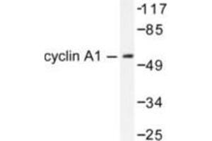 Image no. 2 for anti-Cyclin A1 (CCNA1) antibody (ABIN265378) (Cyclin A1 anticorps)