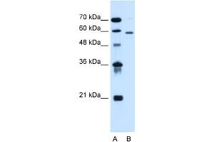 WB Suggested Anti-ALG11 Antibody Titration:  0. (ALG11 anticorps  (C-Term))