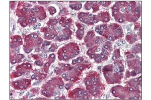 Immunohistochemistry (IHC) image for anti-Protease, serine, 1 (Trypsin 1) (PRSS1) antibody (ABIN614514)