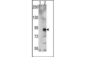 Western blot analysis of EphA5 (arrow) using rabbit polyclonal EphA5 Antibody. (EPH Receptor A5 anticorps)