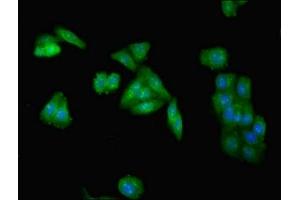 Immunofluorescent analysis of HepG2 cells using ABIN7173954 at dilution of 1:100 and Alexa Fluor 488-congugated AffiniPure Goat Anti-Rabbit IgG(H+L) (INPP5A anticorps  (AA 1-409))