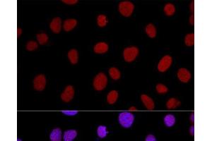 Confocal immunofluorescence analysis of U2OS cells using XRCC5 Polyclonal Antibody at dilution of 1:100.
