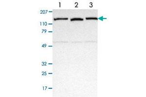 Western blot analysis of Lane 1: Human cell line RT-4 Lane 2: Human cell line EFO-21 Lane 3: Human cell line A-431 with NEK9 polyclonal antibody  at 1:250-1:500 dilution. (NEK9 anticorps)