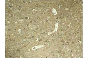 Image no. 3 for anti-Microtubule-Associated Protein tau (MAPT) (pSer404) antibody (ABIN196810) (MAPT anticorps  (pSer404))