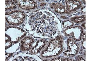 Image no. 3 for anti-Estrogen-Related Receptor gamma (ESRRG) (AA 24-263) antibody (ABIN1491251)