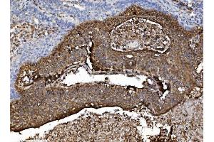 IHC analysis of NSF using anti-NSF antibody (ABIN7601630).