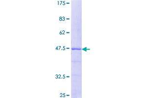 Image no. 1 for Centrin, EF-Hand Protein, 3 (CETN3) (AA 1-167) protein (GST tag) (ABIN1349190)