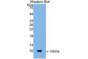 Detection of Recombinant S100B, Mouse using Polyclonal Antibody to S100 Calcium Binding Protein B (S100B)