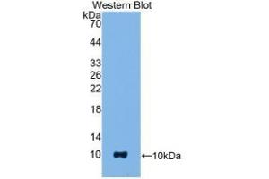 Detection of Recombinant S100B, Mouse using Polyclonal Antibody to S100 Calcium Binding Protein B (S100B) (S100B anticorps  (AA 1-92))