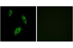 Immunofluorescence analysis of LOVO cells, using GPR174 Antibody. (GPR174 anticorps  (AA 131-180))