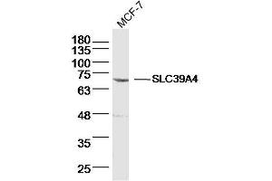 MCF-7 lysates probed with SLC39A4 Polyclonal Antibody, Unconjugated  at 1:300 dilution and 4˚C overnight incubation.