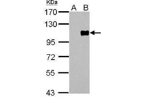 WB Image FOXM1 antibody [C3], C-term detects FOXM1 protein by Western blot analysis. (FOXM1 anticorps  (C-Term))