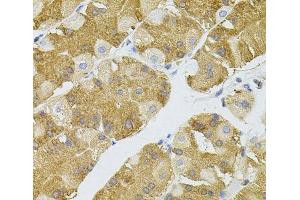 Immunohistochemistry of paraffin-embedded Human stomach using NAT8 Polyclonal Antibody (NAT8 anticorps)