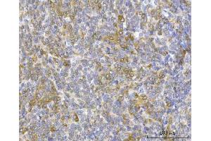 IHC analysis of RRS1 using anti-RRS1 antibody (ABIN7602918).