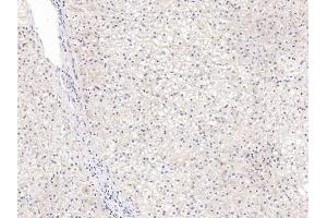 Detection of GPC3 in Human Liver Tissue using Polyclonal Antibody to Glypican 3 (GPC3)