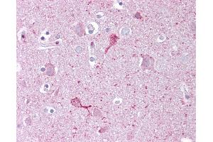 Anti-EGR3 antibody IHC of human brain, cortex.