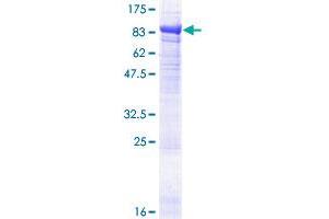Image no. 1 for EPM2A (Laforin) Interacting Protein 1 (EPM2AIP1) (AA 1-607) protein (GST tag) (ABIN1352961)