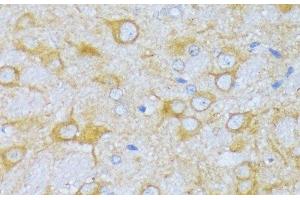 Immunohistochemistry of paraffin-embedded Rat brain using ACADSB Polyclonal Antibody at dilution of 1:100 (40x lens). (ACADSB anticorps)