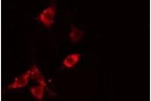 ABIN6275502 staining  HepG2 cells by IF/ICC.