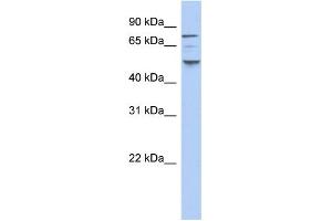 WB Suggested Anti-CSNK1E Antibody Titration: 0. (CK1 epsilon anticorps  (N-Term))