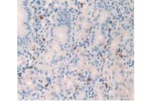 Detection of 0 in Human Stomach Tissue using Monoclonal Antibody to Amylin (Amylin/DAP anticorps)