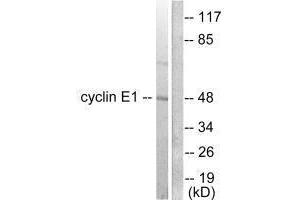 Western blot analysis of extracts from K562 cells, using Cyclin E1 antibody. (Cyclin E1 anticorps)