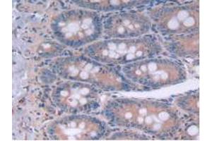 IHC-P analysis of Rat Intestine Tissue, with DAB staining. (IL12A anticorps  (AA 23-215))