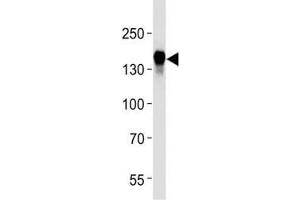 EGF Receptor antibody western blot analysis in HeLa lysate