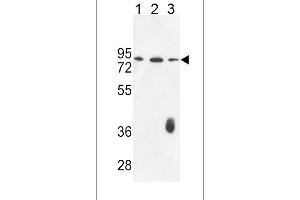 F12 Antibody (N-term) (ABIN653621 and ABIN2842977) western blot analysis in K562(lane 1),CEM(lane 2),MDA-M(lane 3) cell line lysates (35 μg/lane). (F12 anticorps  (N-Term))
