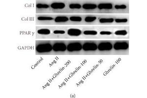 The effect of different concentrations of Ghrelin on collagen I, collagen III, and PPAR-γ protein expression in Ang II-infused rats. (GAPDH anticorps  (AA 1-335))