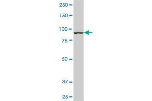 AMPD2 monoclonal antibody (M01), clone 2F5. (AMPD2 anticorps  (AA 86-185))
