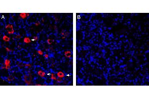 Expression of P2X3 in rat dorsal root ganglion. (P2RX3 anticorps  (Intracellular))