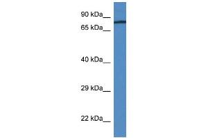 WB Suggested Anti-F2 Antibody   Titration: 1. (Prothrombin anticorps  (N-Term))