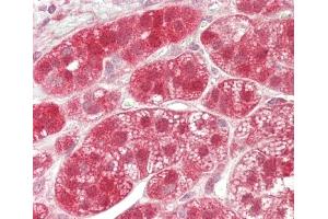 Formalin-fixed and paraffin-embedded H.