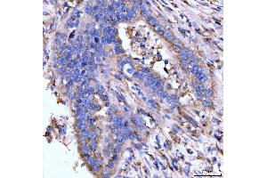 IHC analysis of Giantin/GOLGB1 using anti-Giantin/GOLGB1 antibody (ABIN7600139). (Golgin B1 (GOLGB1) (AA 153-950) anticorps)